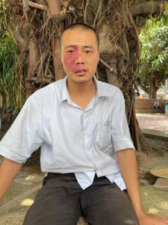 走失者照片 深圳寻亲：青年男子被救助，高约1米...