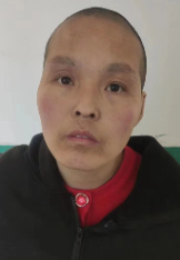 走失者照片 保定寻亲：中年女子被救助，高1米5...
