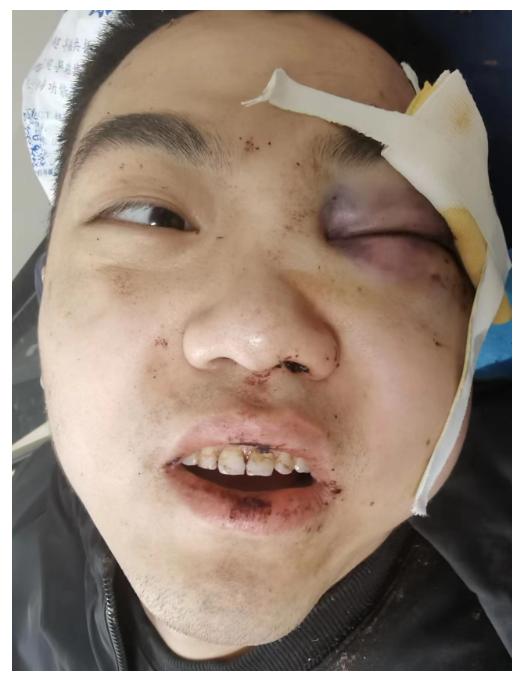走失者照片 廊坊霸州寻亲：青年男子遭遇车祸被送...