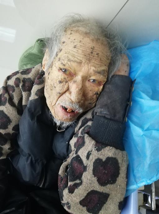 走失者照片 济南寻亲：八旬老人被救助，自述叫黄...
