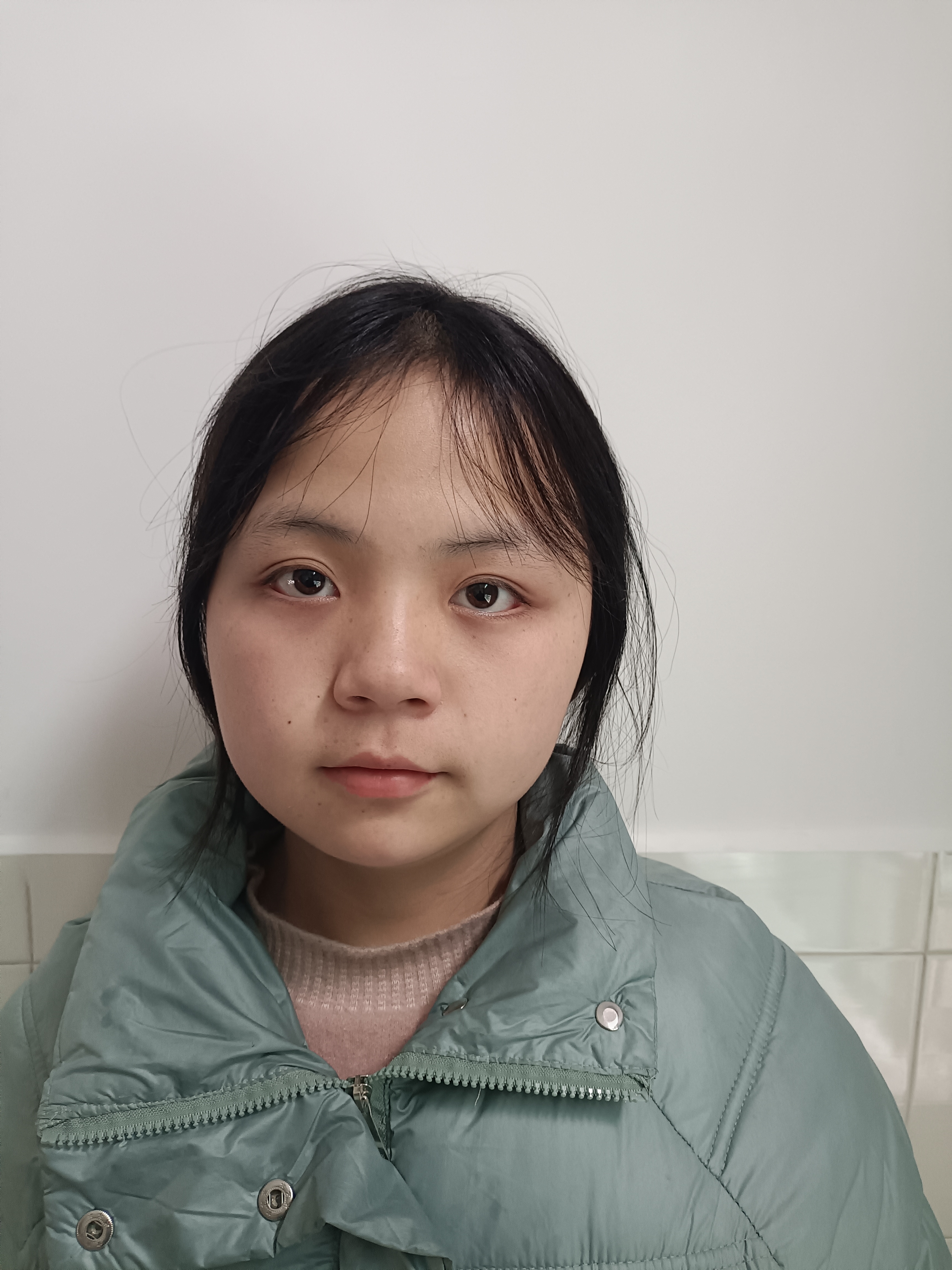 走失者照片 清远寻亲:14岁女孩自幼被救助