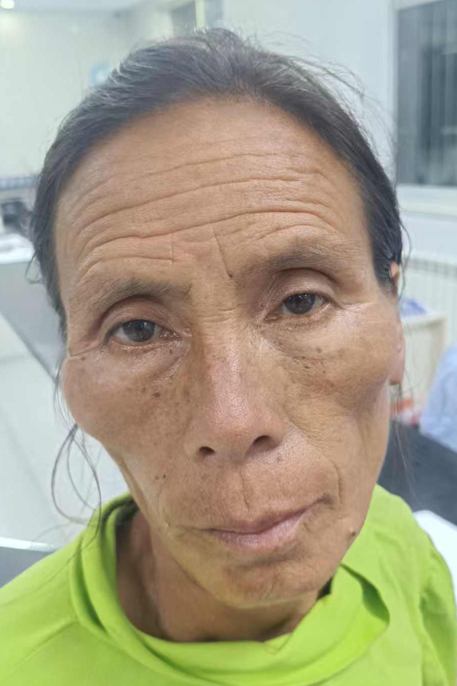 走失者照片 全国救助站