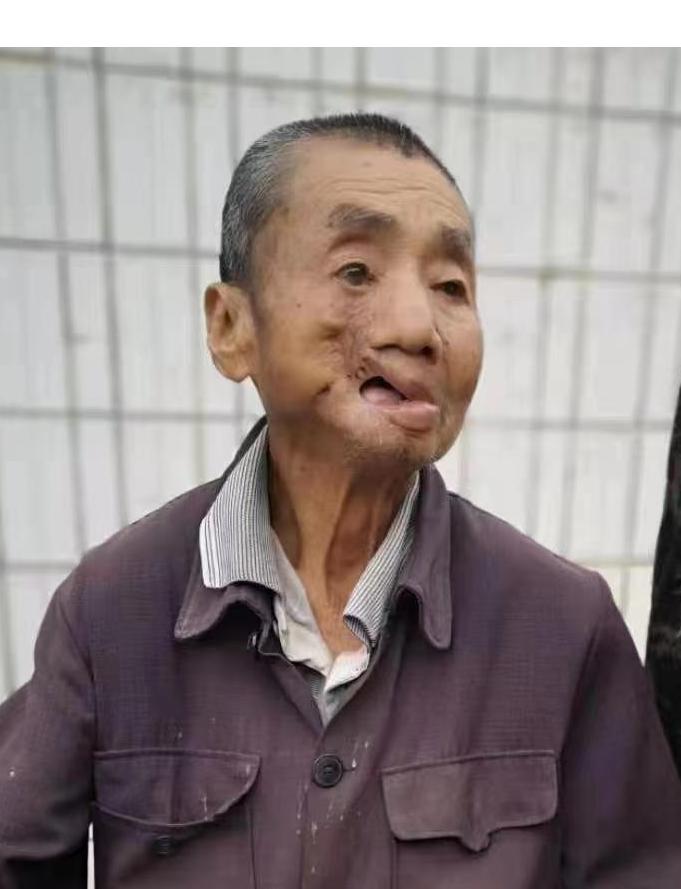 走失者照片 泉州南安寻人：七旬老人失联，穿黑色...