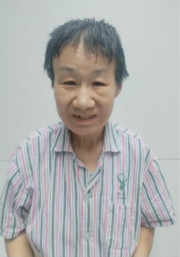 走失者照片 乌鲁木齐市寻亲：五旬女子被救助，自...