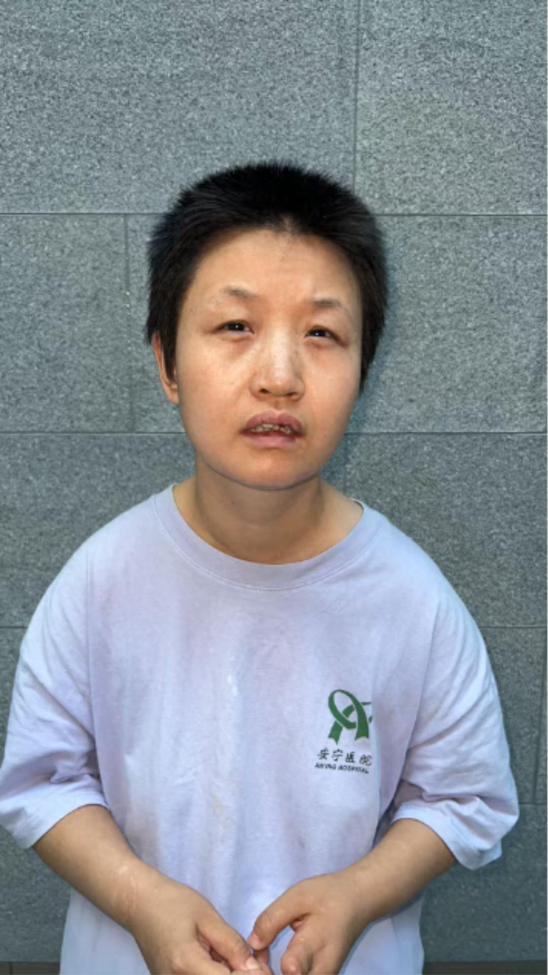 走失者照片 乌鲁木齐市寻亲：青年女子被救助，自...