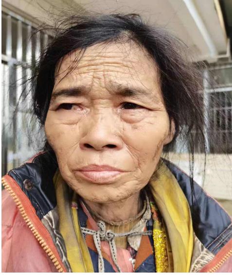 走失者照片 云浮寻亲：五旬女子被救助，不与人沟...
