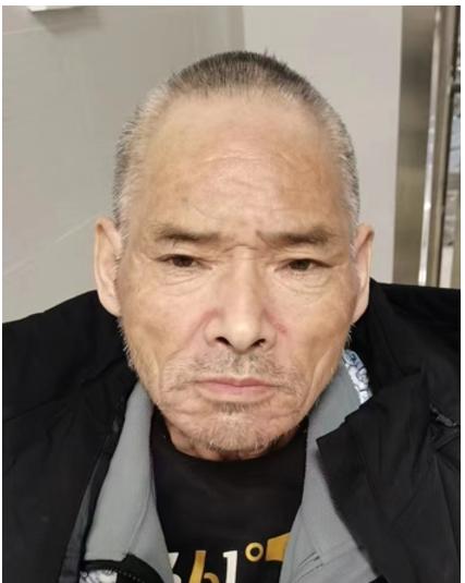 走失者照片 南阳寻亲：六旬老人被救助，患肢体残...