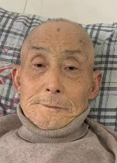 走失者照片 成都寻亲：七旬老人被救助，自述叫刘...