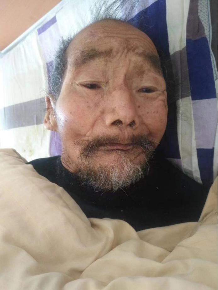 走失者照片 南阳寻亲：七旬老人被救助，穿黑色上...