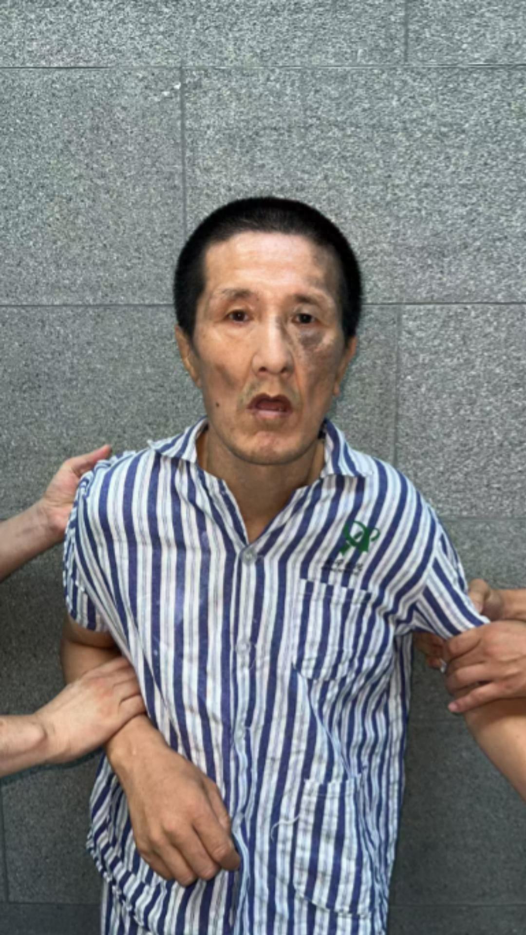 走失者照片 乌鲁木齐市寻亲：中年男子被救助，面...