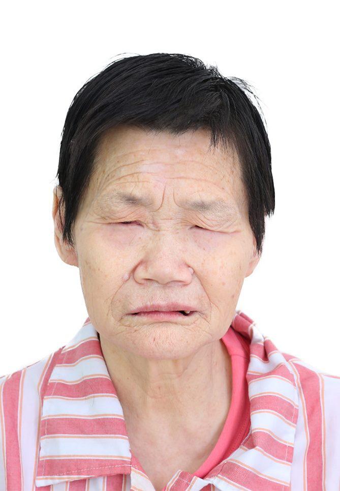 走失者照片 佛山寻亲：五旬女子被救助多年，疑似...