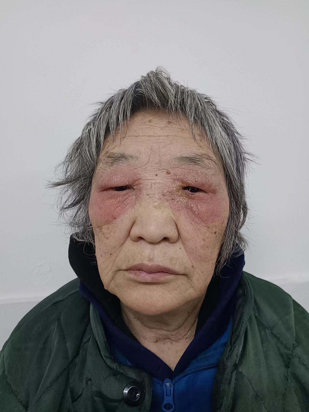 走失者照片 邵阳市寻亲：六旬老太被救助，穿蓝色...