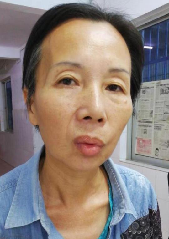 走失者照片 海南寻亲：五旬女子被救助多日，自述...