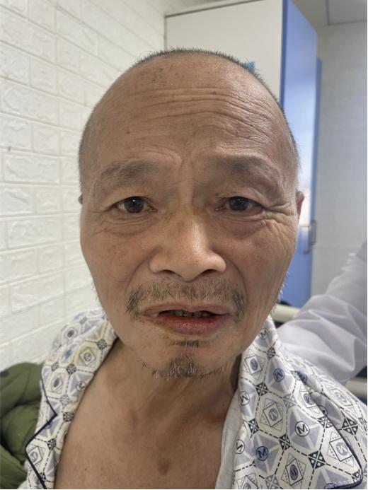 走失者照片 昆明寻亲：六旬老人被救助，自述叫李...