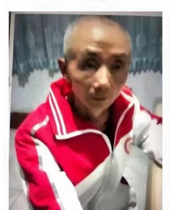 走失者照片 广安寻人：六旬老人走失，患脑萎缩，...