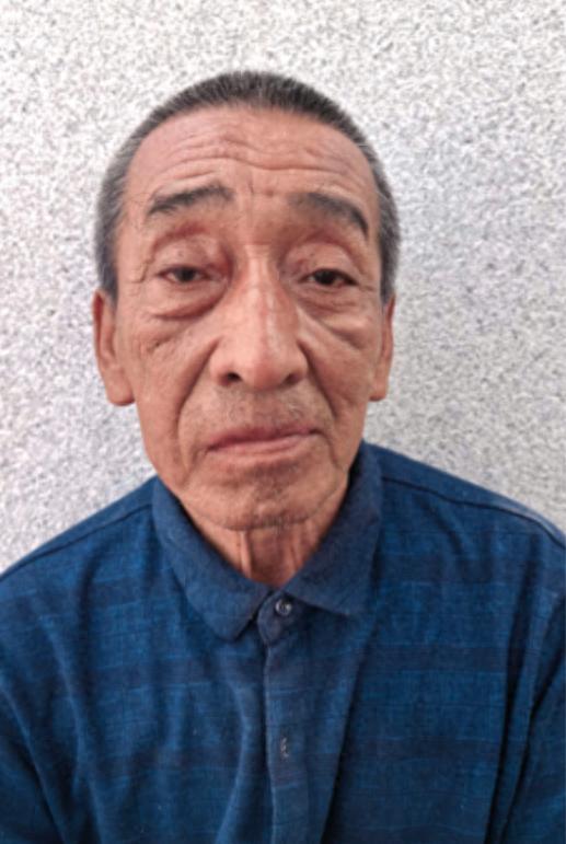 走失者照片 包头市寻亲：六旬老人被救助，穿深蓝...