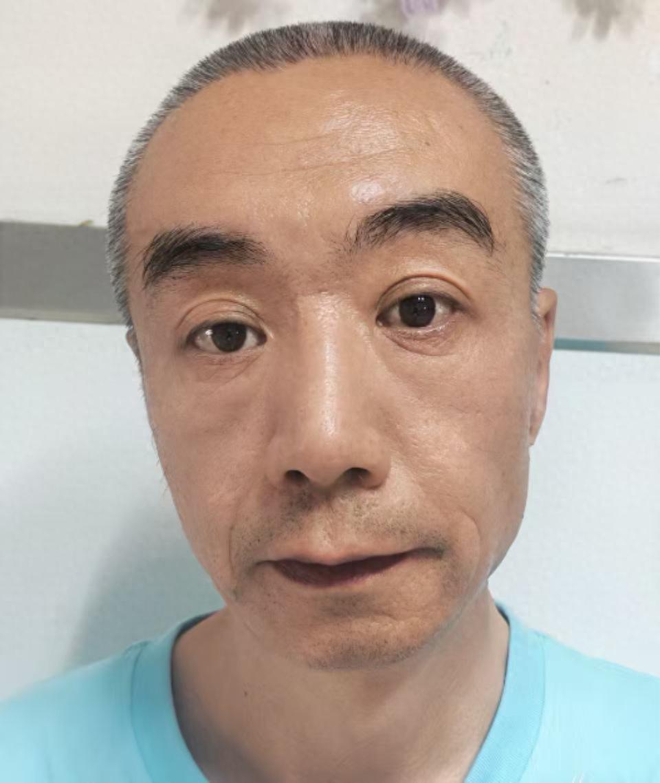 走失者照片 乌鲁木齐市寻亲：五旬男子被救助，自...