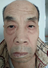 走失者照片 乌兰察布寻亲：六旬老人被救助，自述...