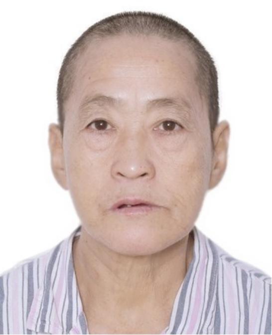 走失者照片 江门台山市寻亲：六旬老太被救助多年...