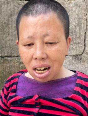 走失者照片 广安华蓥寻亲：五旬女子被救助多年，...