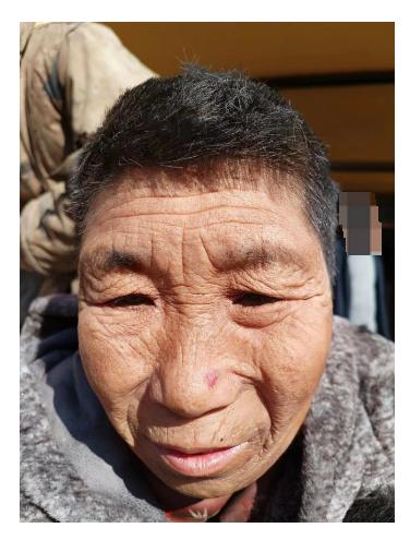 走失者照片 铁岭寻亲：六旬老太被救助，高1米7