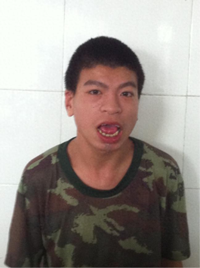 走失者照片 泉州市寻亲：青年男子被救助，高约1...