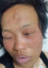 走失者照片 南阳寻亲：邓州青年女子被救助，额头...