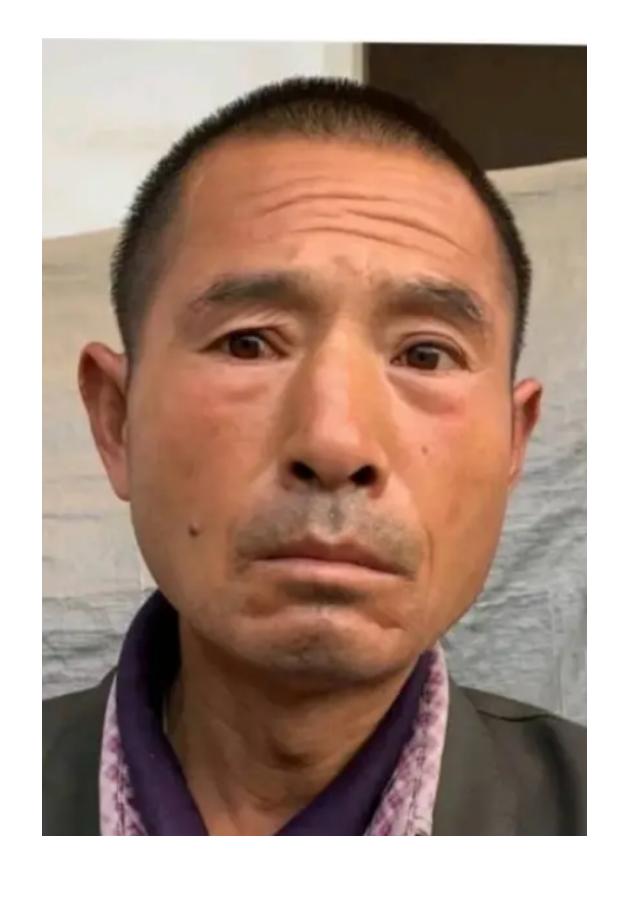 走失者照片 宝鸡寻人：五旬男子走失，患精神障碍...