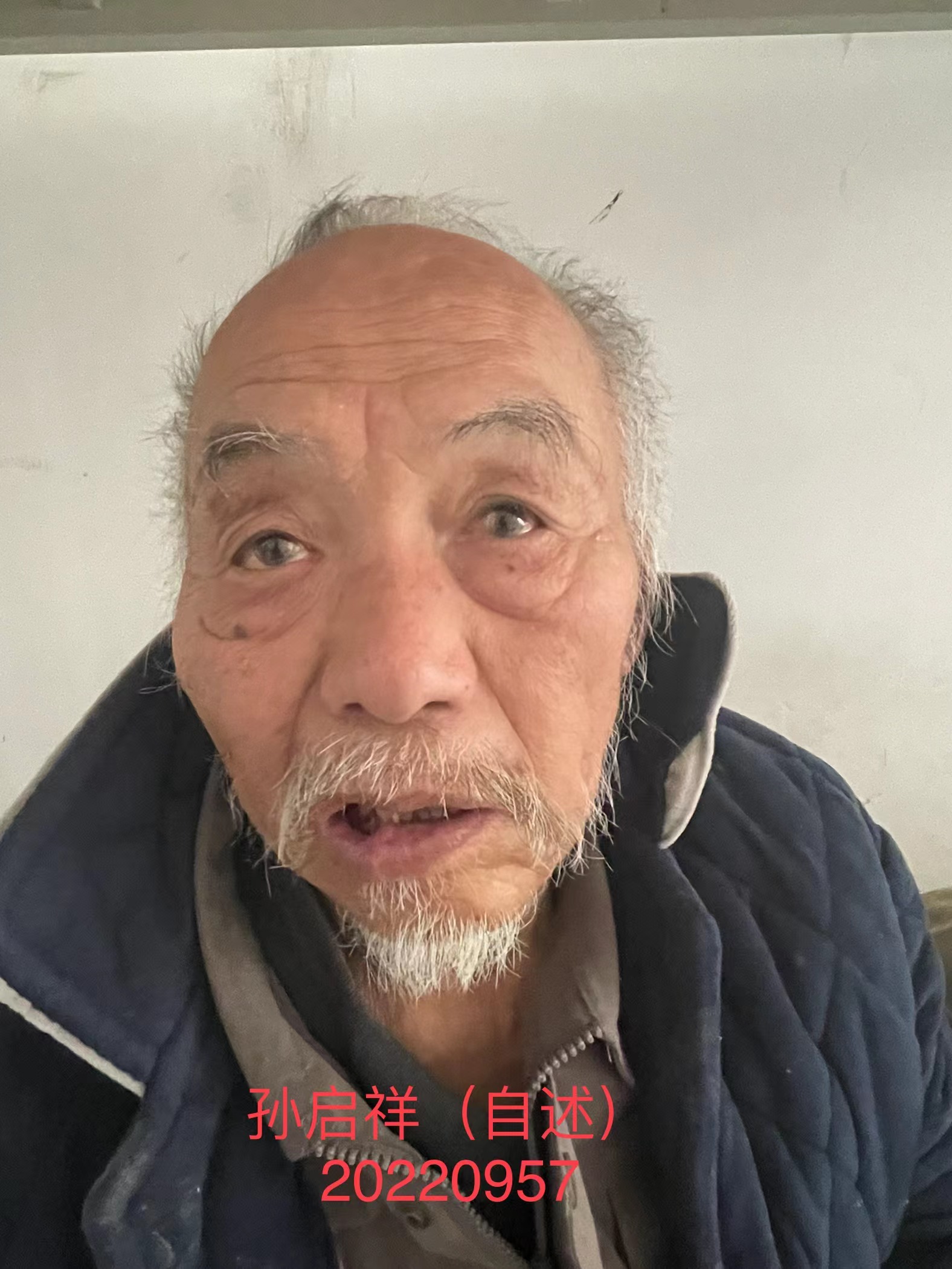走失者照片 贵阳寻亲：七旬老人被救助，自述叫孙...