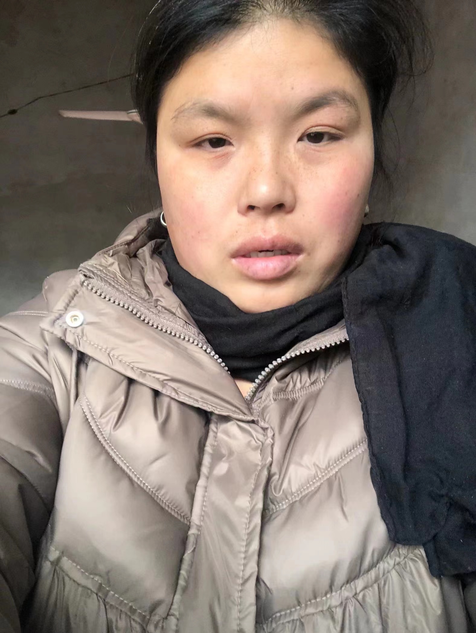 走失者照片 菏泽急寻：青年女子走失，穿咖色毛领...