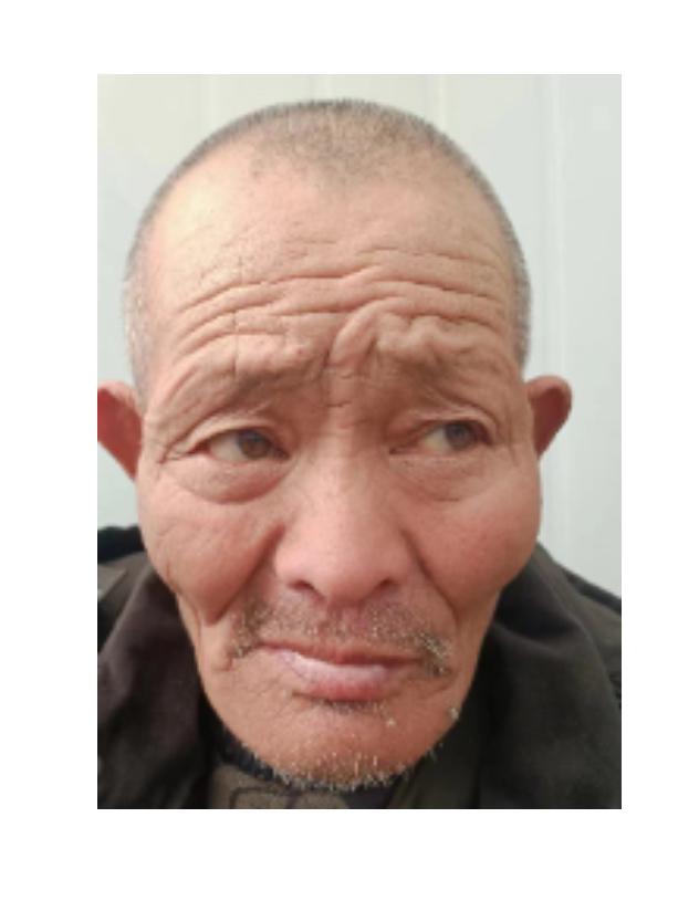走失者照片 南阳寻亲：六旬老人被救助，偏瘦，高...