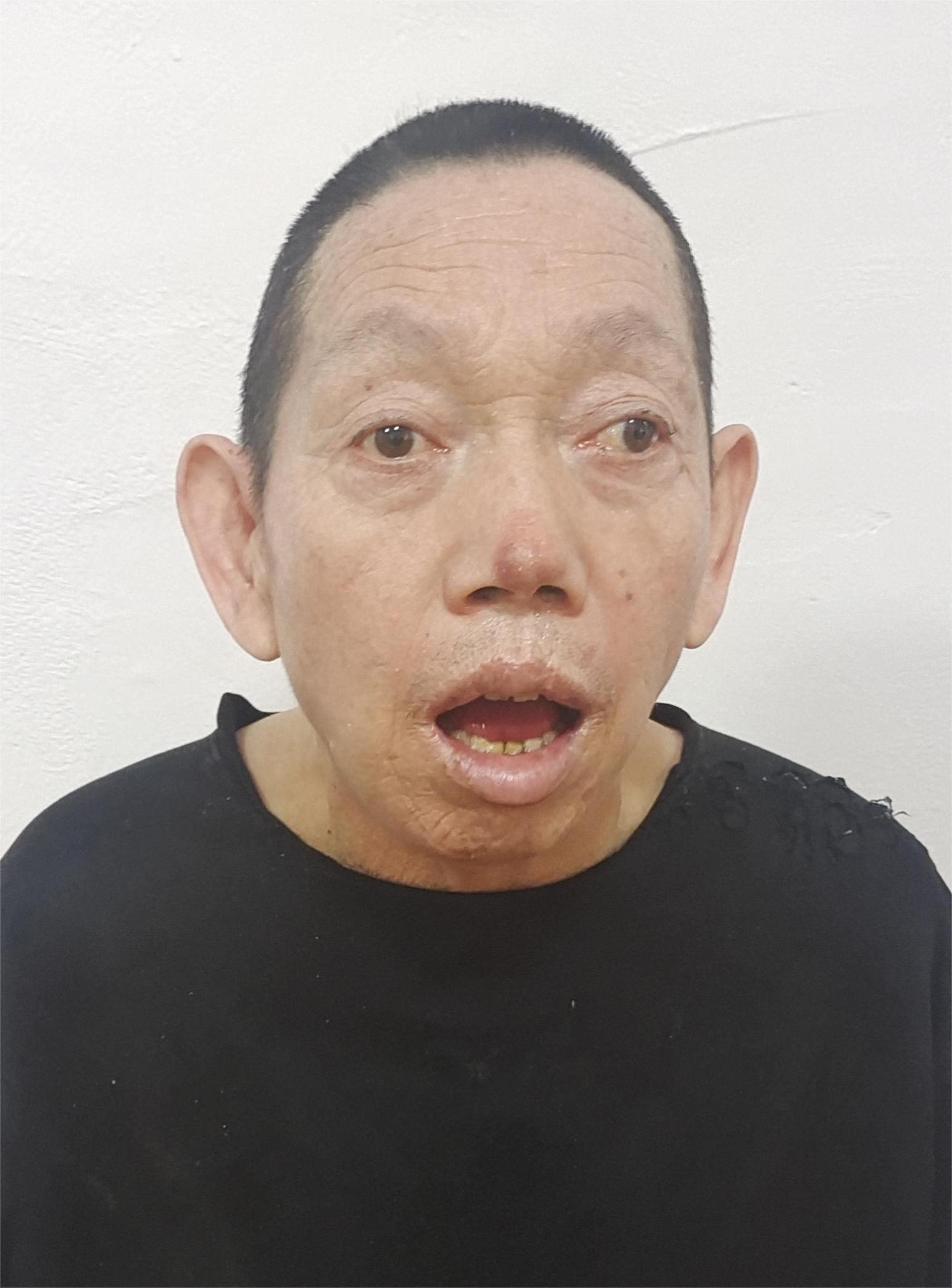 走失者照片 汕尾陆丰寻亲：中年男子被救助，精神...