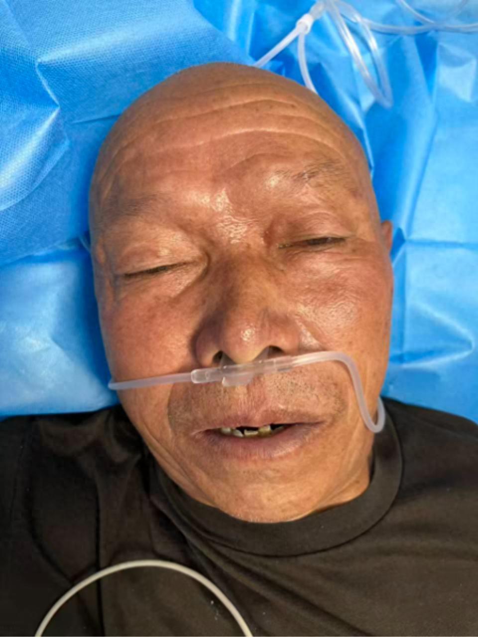 走失者照片 南充市寻亲：七旬老人因脑出血昏迷被...