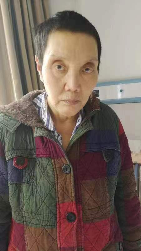 走失者照片 重庆寻亲：中年女子被救助，高1米5...