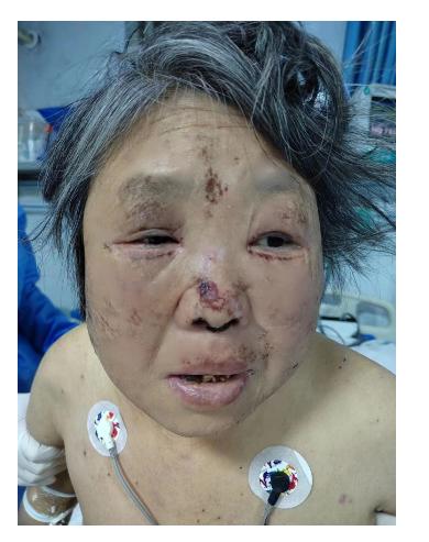 走失者照片 周口寻亲：五旬女子被救助，穿黑色棉...