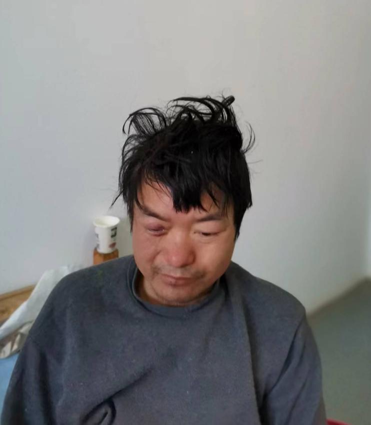 走失者照片 安庆市望江县救助站：中年男子被救助...
