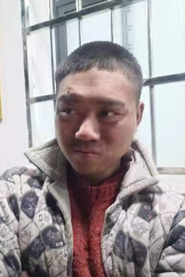 走失者照片 帮他回家：衡阳青年男子被救助，穿灰...