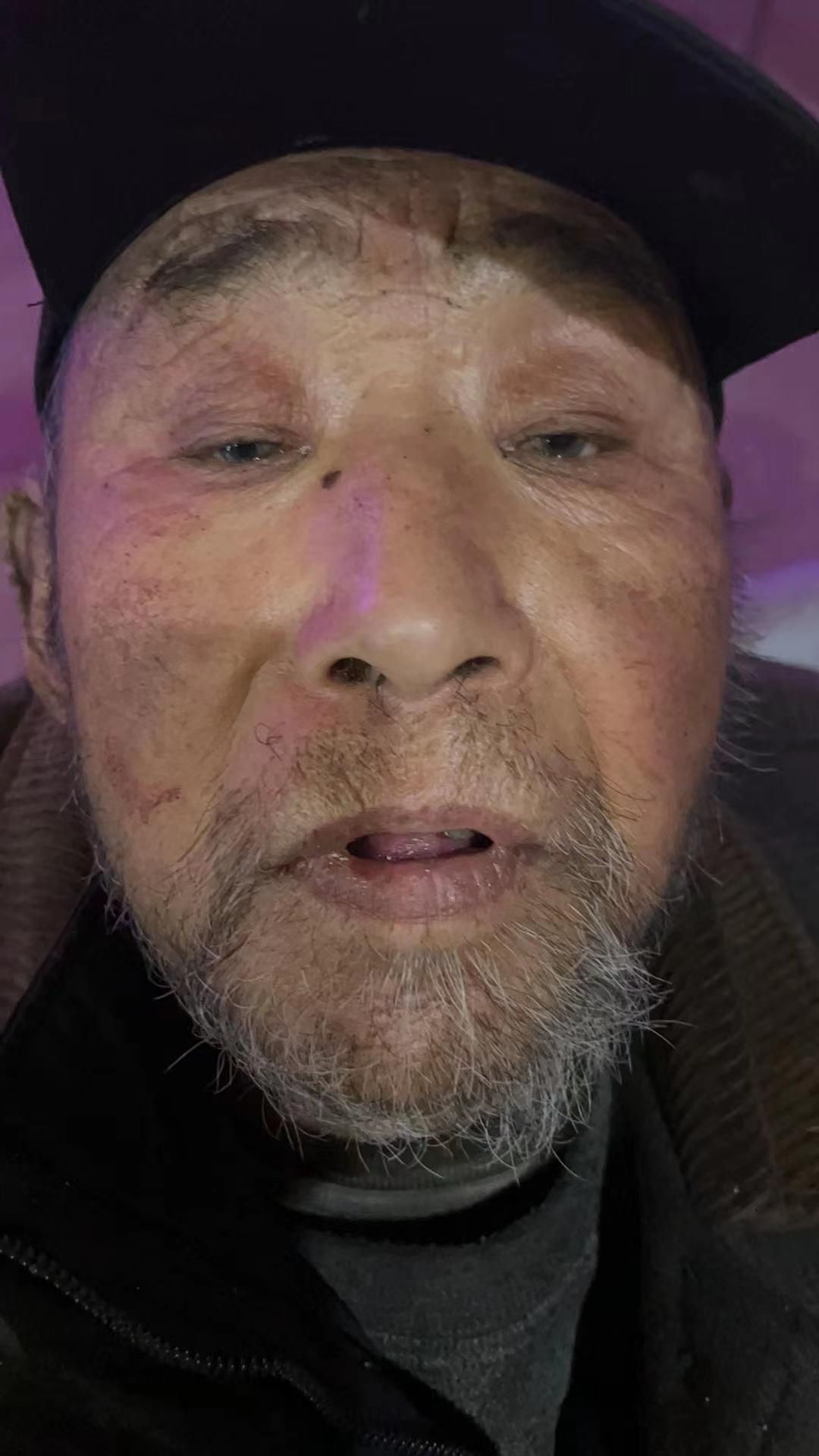 走失者照片 大同寻亲：六旬老人被救助，自述叫张...