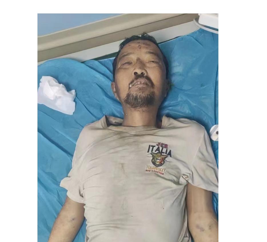 走失者照片 泉州南安寻亲：中年男子被救治，因多...