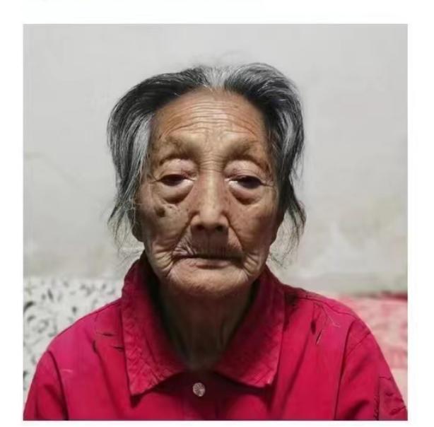 走失者照片 洛阳急寻：八旬老太走失，穿蓝色中长...