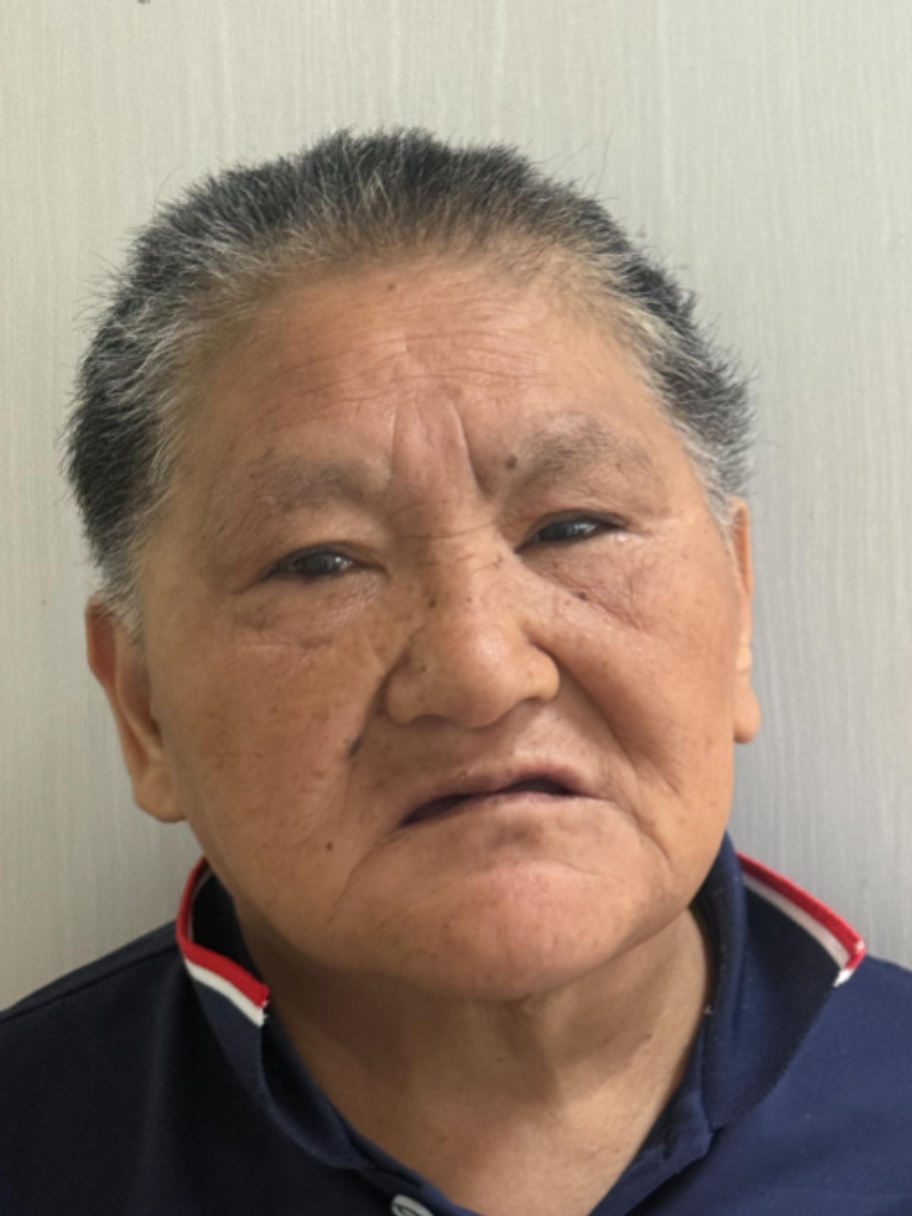走失者照片 信阳市寻亲：六旬老太被救助，受助时...