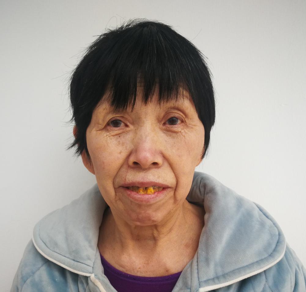 走失者照片 徐州寻亲：邳州五旬女子被救助，穿花...