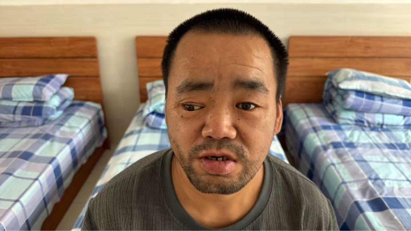 走失者照片 寻亲：中年男子在齐齐哈尔被救助，自...