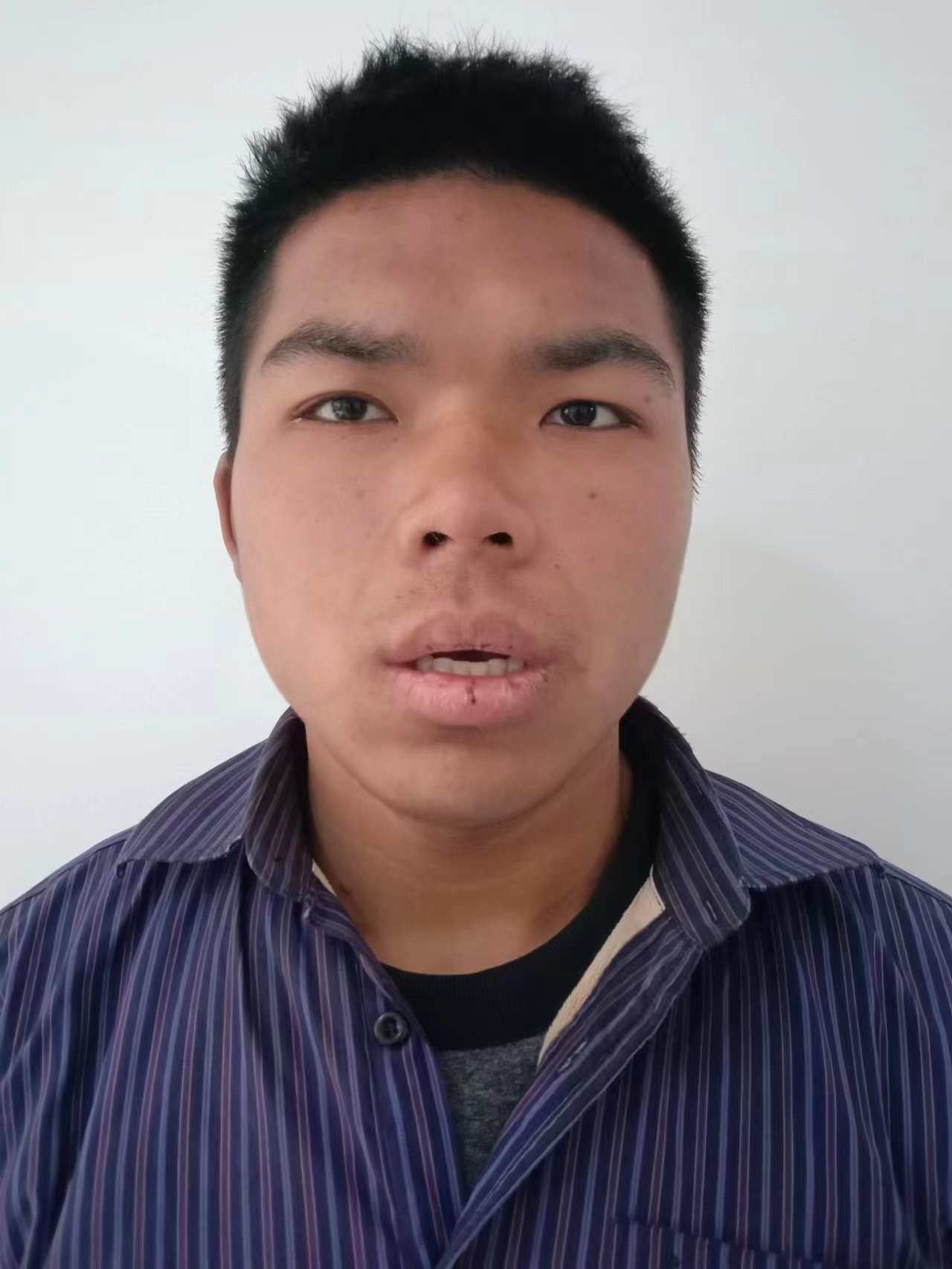 走失者照片 吴忠青铜峡寻亲：青年男子被救助，自...