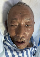 走失者照片 海口寻亲：中年男子被救助，白发，偏...