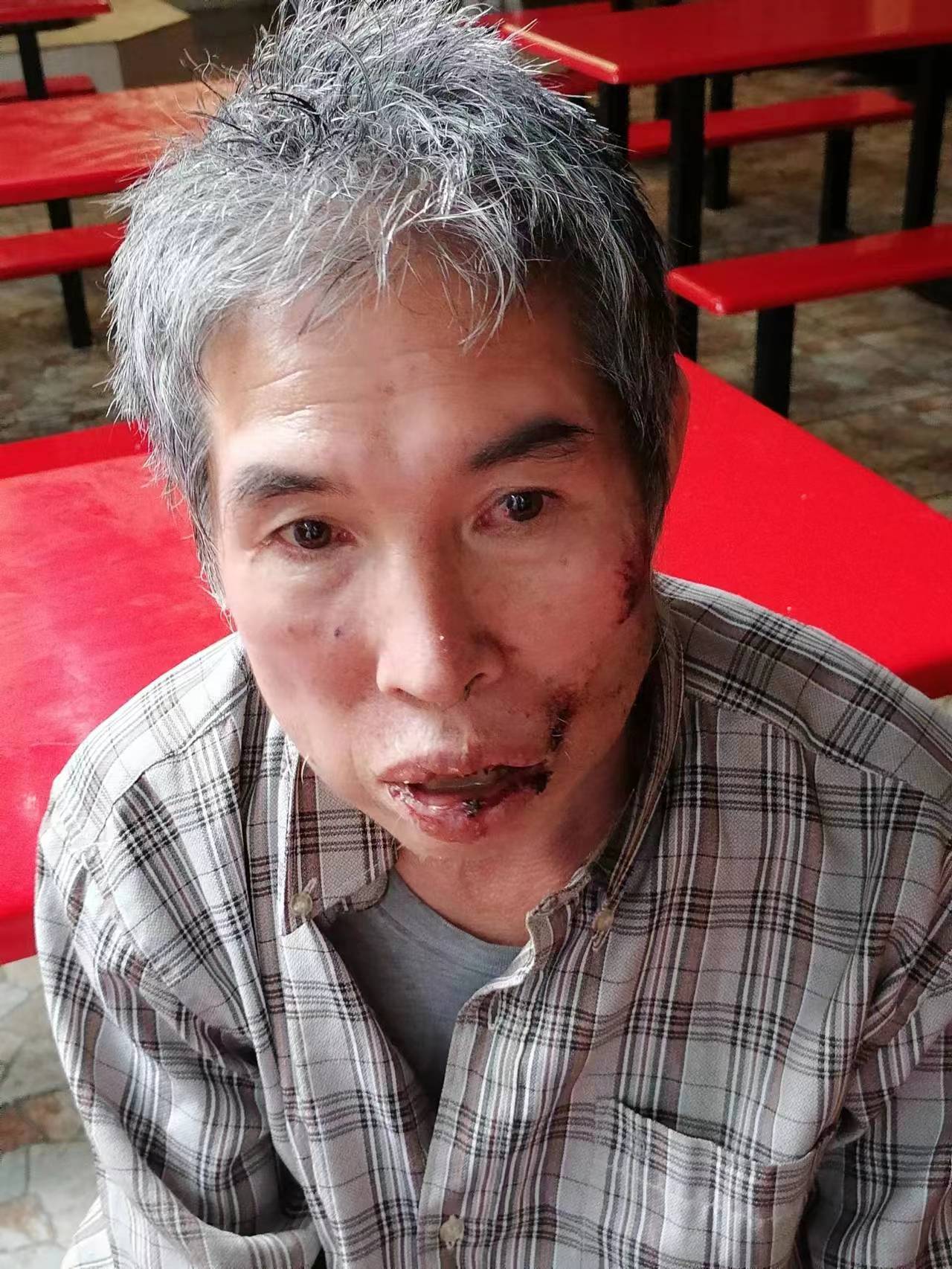 走失者照片 万宁寻亲：五旬男子被救助，面部有挫...