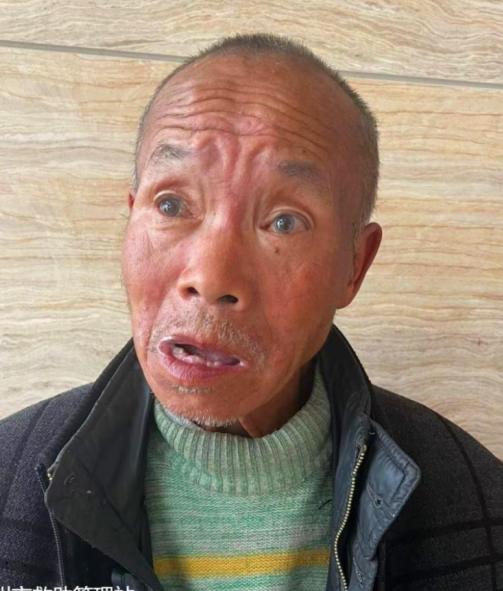 走失者照片 抚州寻亲：六旬老人被救助，穿深灰色...
