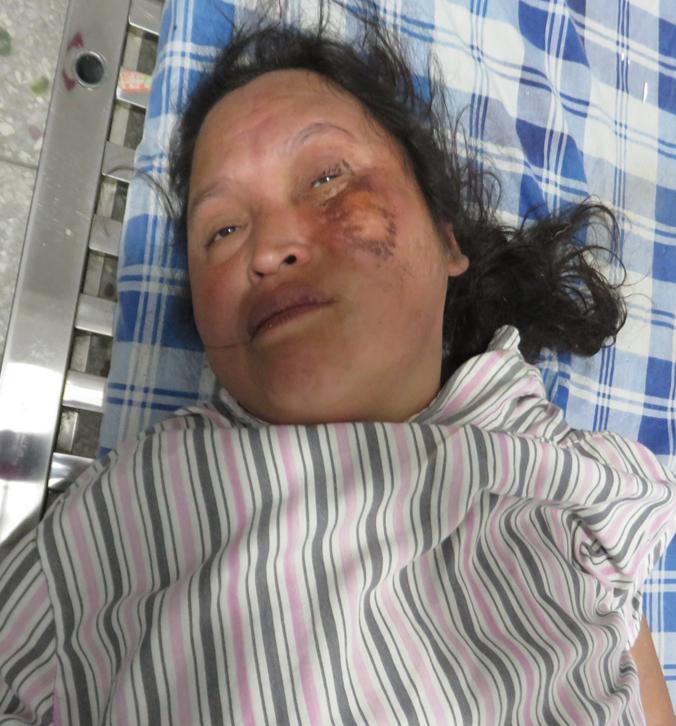 走失者照片 玉林寻亲：中年女子被救助，穿浅棕色...