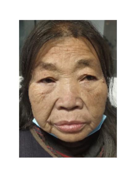 走失者照片 遂宁寻亲：六旬老太被救助，穿藏蓝色...