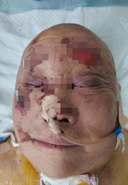 走失者照片 患者寻亲：六旬老人在新乡因交通事故...